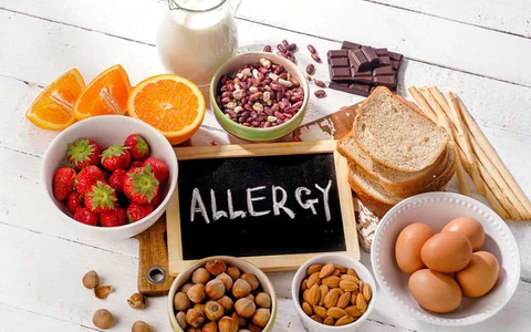 food allergist
